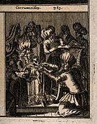 Circoncision par un mohel, 1682