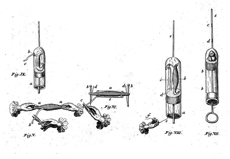 File:Detail of experiments on frog muscle. Wellcome L0011443.jpg