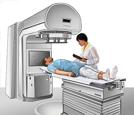 Setup for radiation therapy. The person lies flat while a radiation beam is focused on the tumour site.