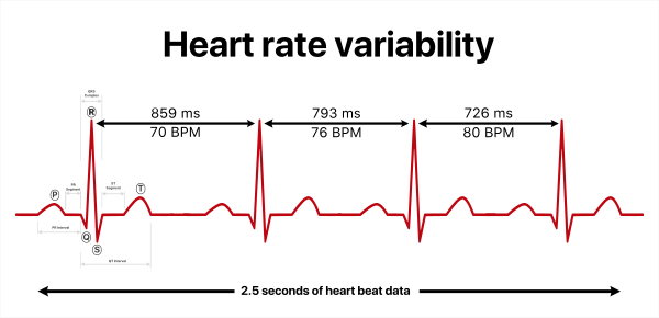 Heart rate variability (HRV).svg