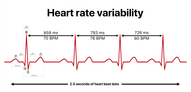 Heart Rate Variability Wikipedia 5554