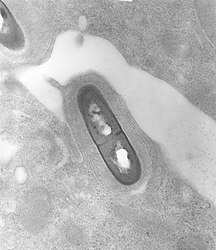 Electron micrograph of Listeria monocytogenes bacterium in tissue