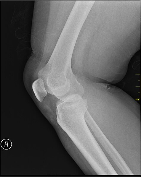 File:Medical X-Ray imaging RCW06 nevit.jpg