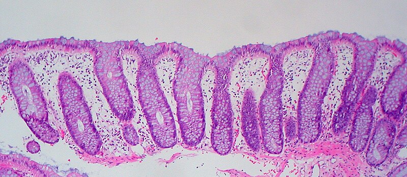 File:Normal colonic mucosa.jpg