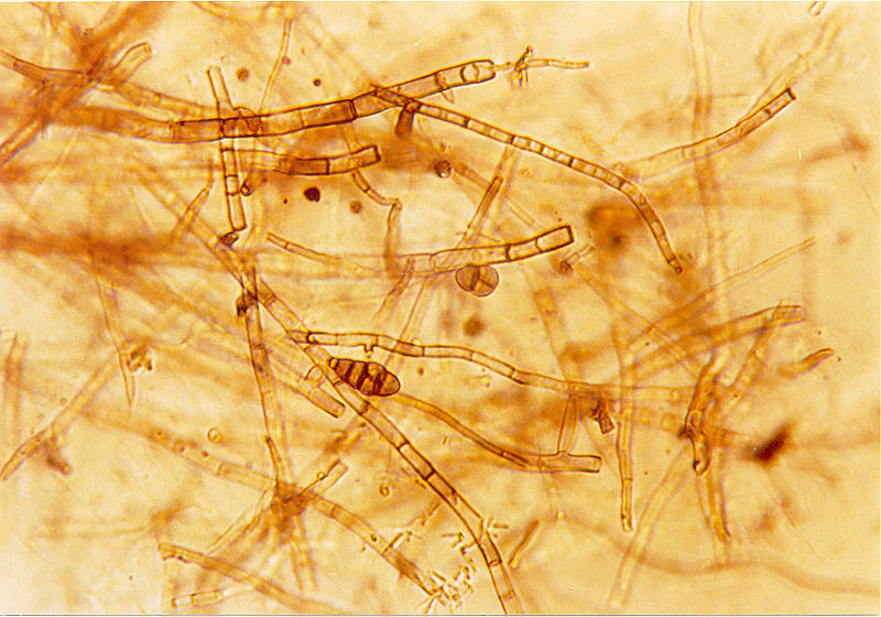 File:Septate hyphae of the fungus Alternaria sp.jpg