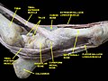 Ankle joint. Deep dissection. Medial view