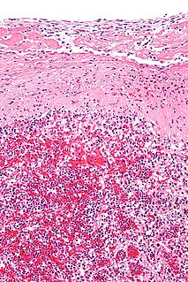 Hyaline biological substance with a glassy appearance