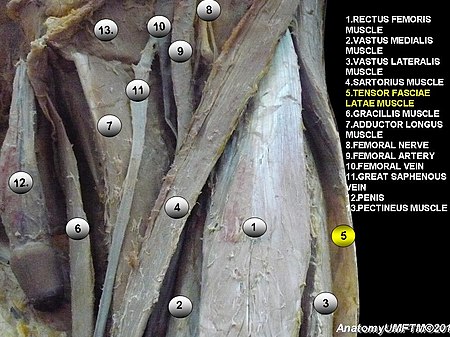 Anatomical dissection5.JPG