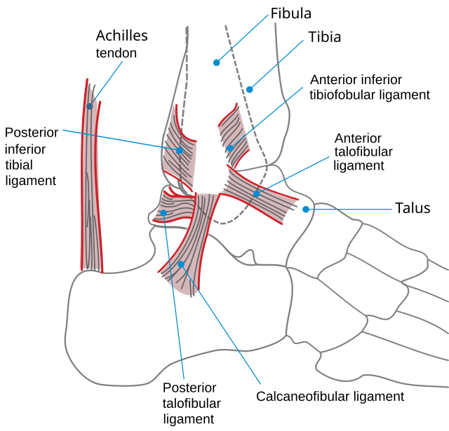 Sprained ankle - Wikipedia