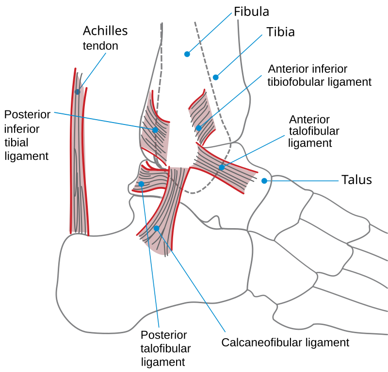 Sprained ankle - Wikipedia