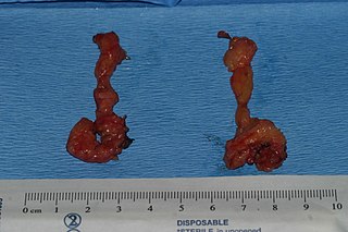 <span class="mw-page-title-main">Buccal fat pad</span> Organ of the face