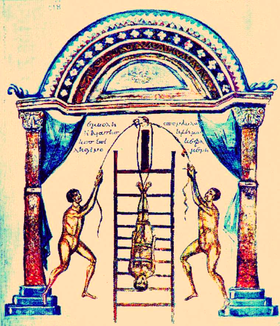 A sketch of 16th a century arm stretcher, an early bone setting device  (