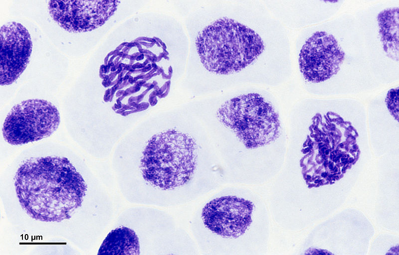 File:Mitosis (261 02) Pressed; root meristem of Vicia faba (cells in prophase).jpg