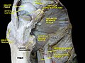 Obturator externus muscle.Deep dissection.Anterior view.