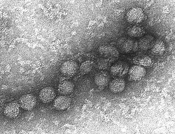 Електронна снимка на вируса, причиняващ заболяването