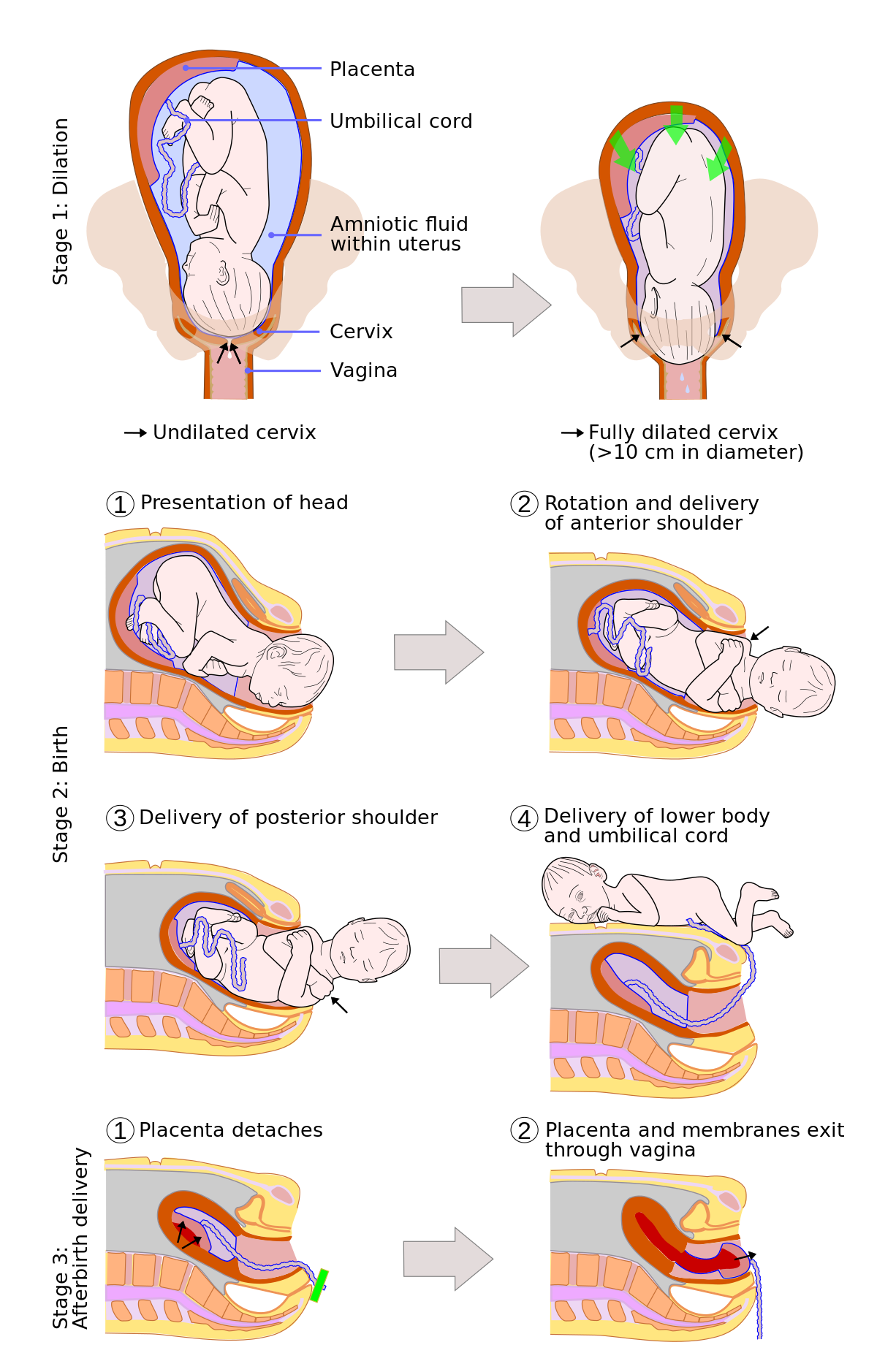 Vaginal delivery - Wikipedia