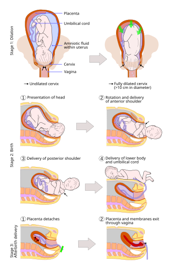 Childbirth - Wikipedia