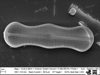 Diatom Achanthes trinodis
