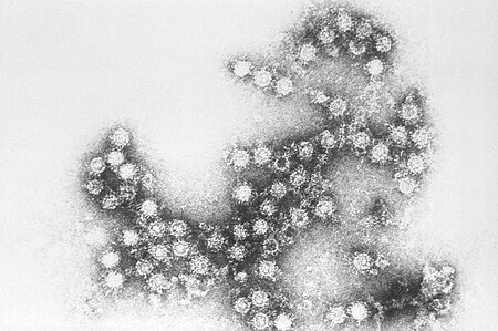 Coxsackie virus B