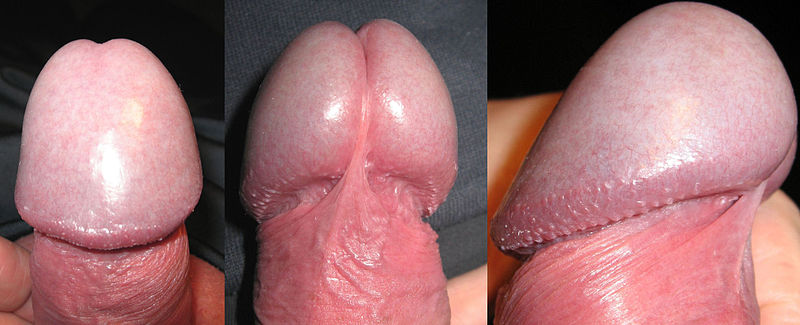 File:Glans penis.JPG