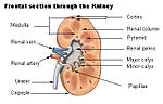 Thumbnail for Renal papillary necrosis