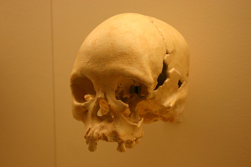 File:Lapa Vermelha IV Hominid 1-Homo Sapiens 11,500 Years Old.jpg