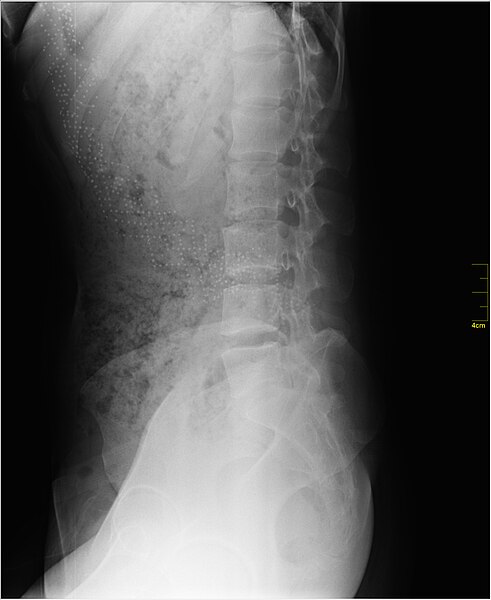 File:Medical X-Ray imaging TYM07 nevit.jpg