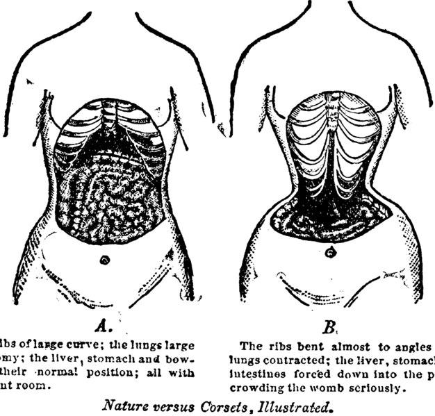 File:Nature versus corsets, illustrated LCCN2002716762.tif