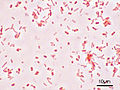 Salmonella typhimurium in dr Gramfärbig 1000-mol vergröösseret