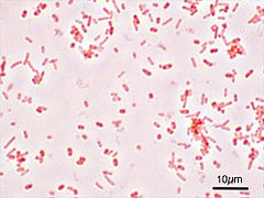 Gastroenteritis: Epidemiologie, Ursachen, Übertragung