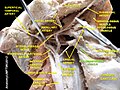 Dissecció on apareix el múscul estilofaringi.