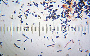 Lactobacillus acidophilus (after Gram stain)