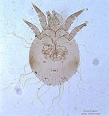 Mite under microscope
