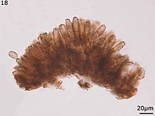 Asperisporium caricae conidiophores and conidium.jpg