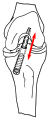 Vorschaubild der Version vom 20:20, 2. Apr. 2010