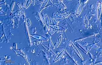 Diatoms are one of the most common types of phytoplankton