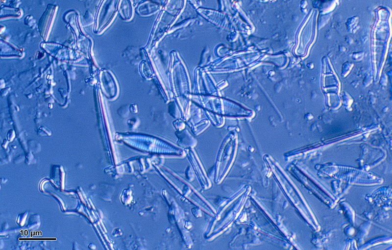 File:Diatoms (248 05) Various diatoms.jpg