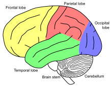 Frontal akinetic mutism can occur after a frontal lobe injury Gehirn, lateral - Lobi eng.svg