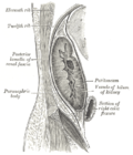 Thumbnail for Loin pain hematuria syndrome