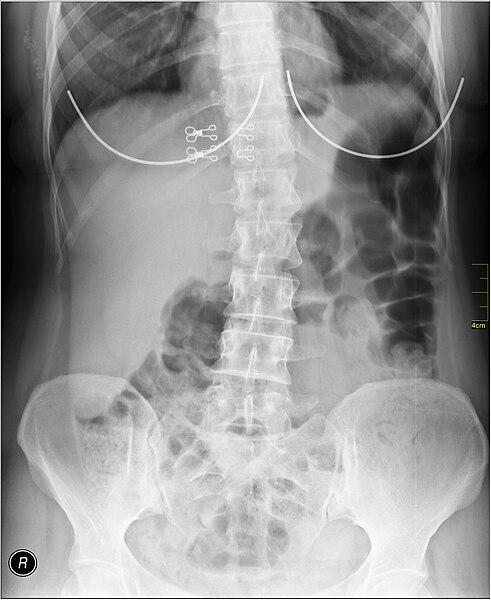 File:Medical X-Ray imaging TFD07 nevit.jpg