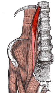 Psoas minor muscle