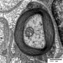 Vorschaubild für Myelin