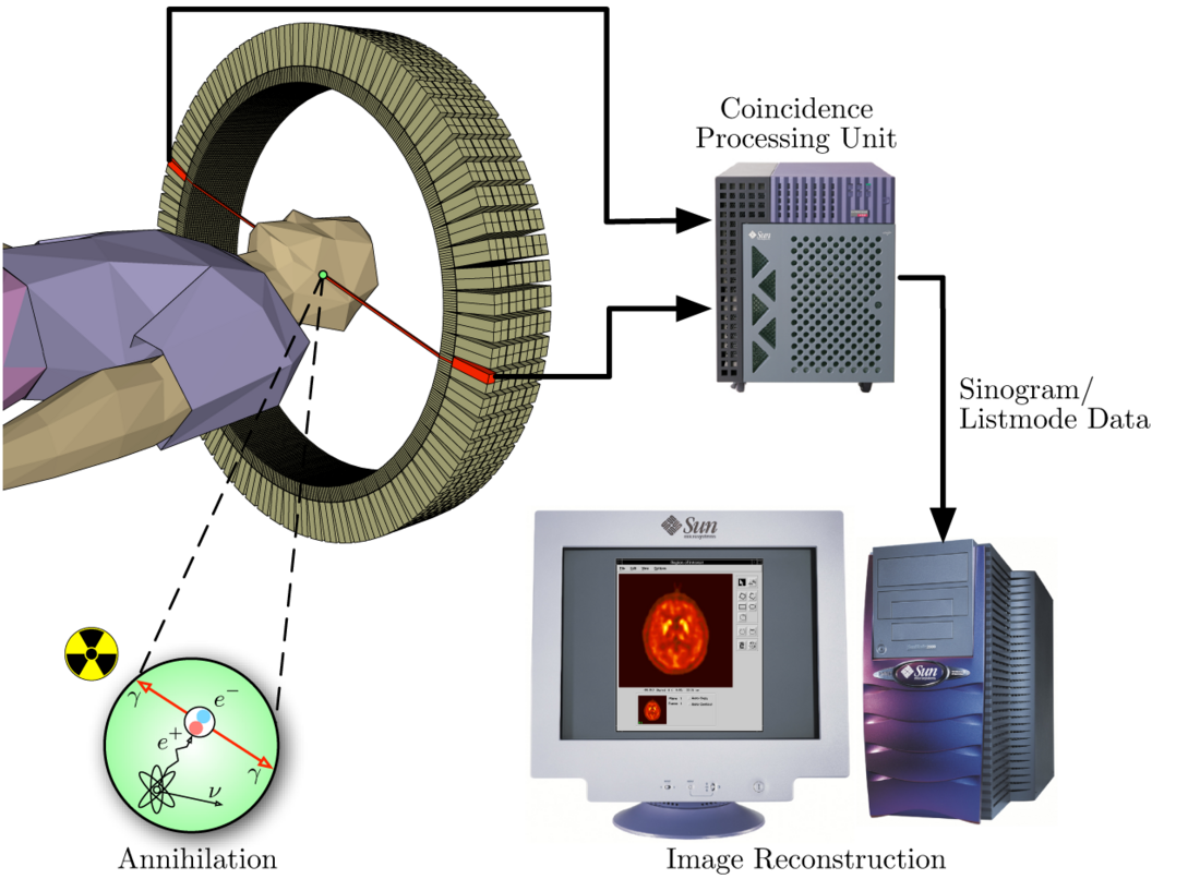 Technik der Positronen-Emissions-Tomographie