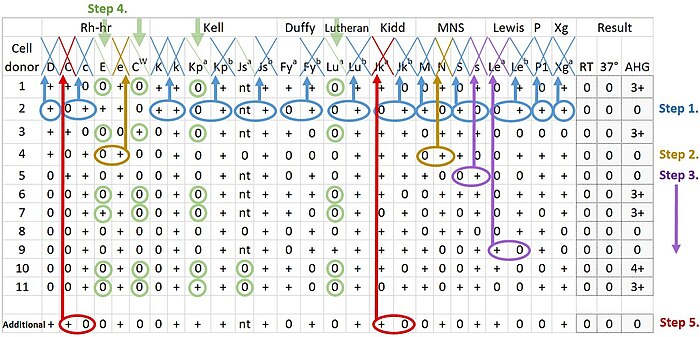 Interpretation of antibody panel used in serology to detect patient antibodies towards the most relevant human blood group systems. .mw-parser-output .hatnote{font-style:italic}.mw-parser-output div.hatnote{padding-left:1.6em;margin-bottom:0.5em}.mw-parser-output .hatnote i{font-style:normal}.mw-parser-output .hatnote+link+.hatnote{margin-top:-0.5em}Further information: Blood compatibility testing