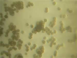 Ustilago maydis diploid teleospores 160X.png