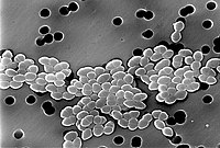 Micrografia em preto e branco: uma banda de bactérias em forma de esfera, agrupada em pares, se estende por um campo cinza.