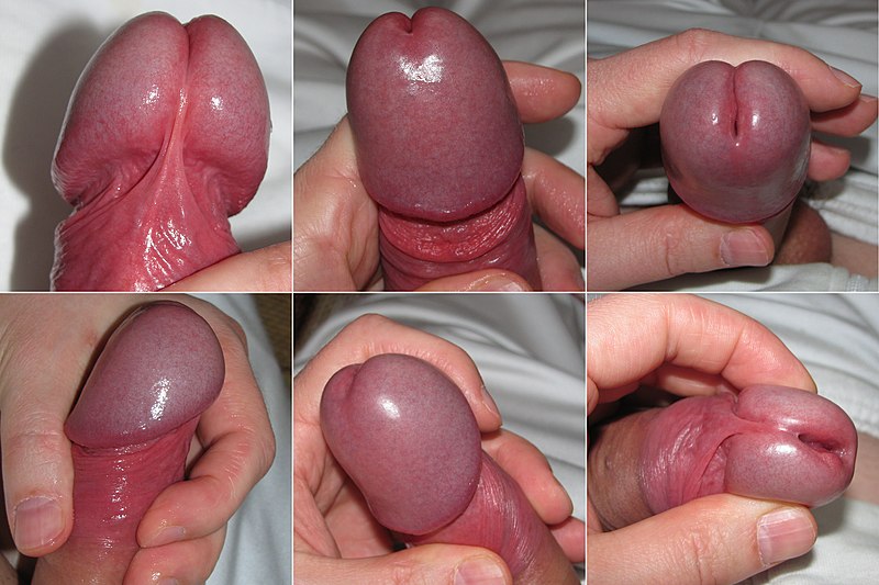 File:A high resolution collage of glans penis.JPG