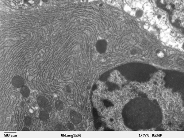 Micrograph of rough endoplasmic reticulum network around the nucleus (shown in the lower right-hand area of the picture). Dark small circles in the network are mitochondria.