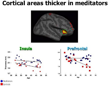 Uma pesquisa de Sarah Lazar et al. (2005) descobriu áreas cerebrais mais espessas em praticantes de meditação insight do que indivíduos que não meditam.[36]