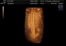 Archivo: Columna vertebral fetal 19 semanas Dr. Wolfgang Moroder.theora.ogv